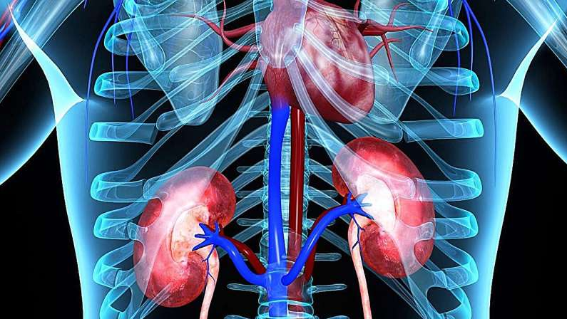 Nearly One in Three People With Type 2 Diabetes May Develop Cardiorenal Disease Within Five Years