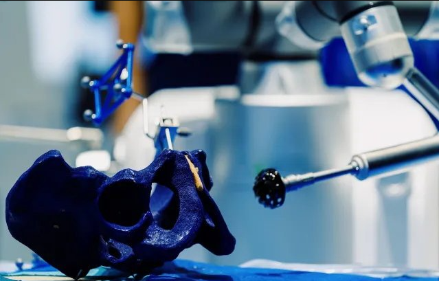 Robotic Hip and Knee Replacement Surgery May Not Reduce the Risk of Early Repeat Surgery